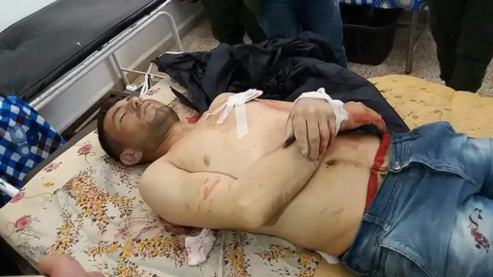 استشهاد مدني وإصابة طفل برصاص جيش الاحتلال التركي على الحدود