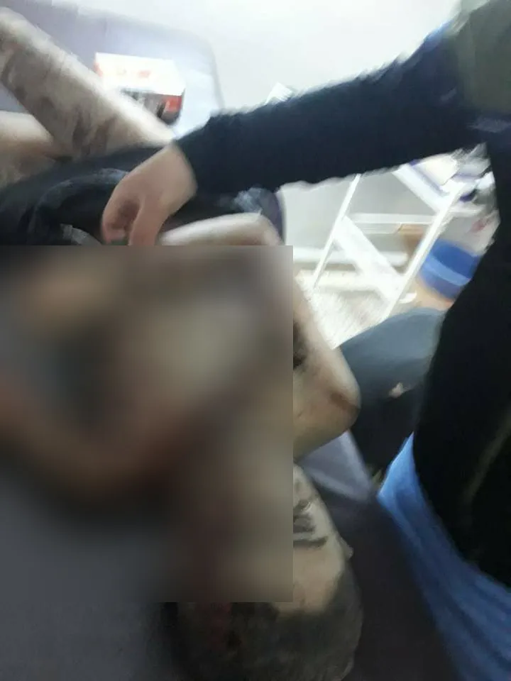 فقدان طفلين لحياتهما إثر انفجار لغم بسري كانيه