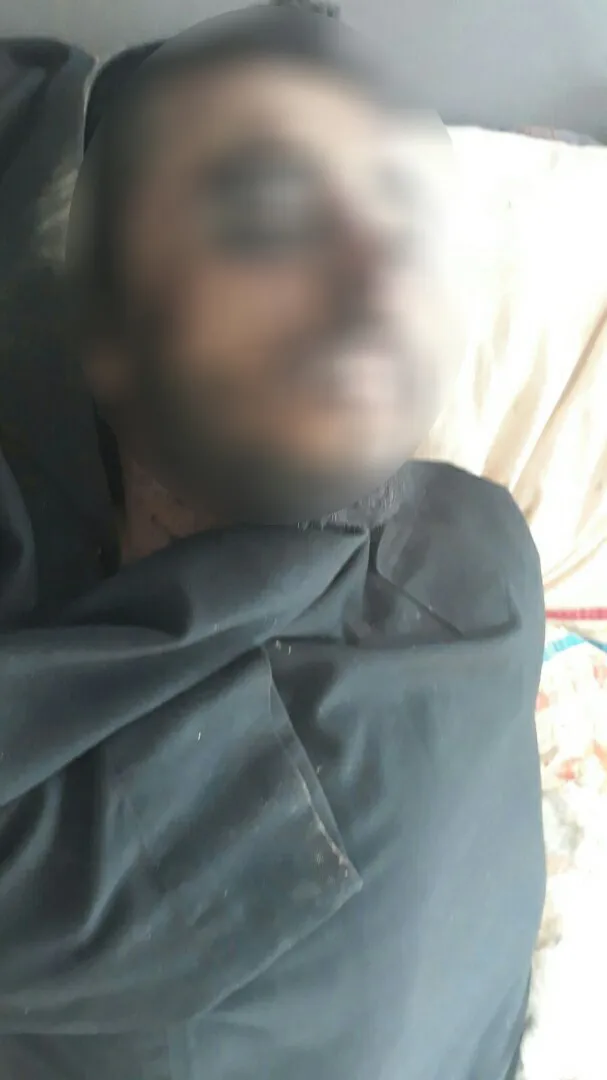 العثور على جثتي المواطنين اللذان اختطفهما جيش الاحتلال التركي يوم أمس