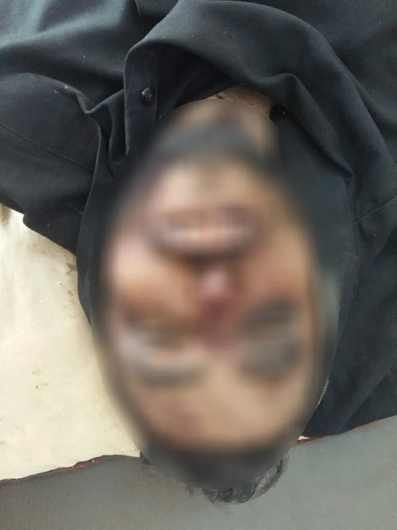 العثور على جثتي المواطنين اللذان اختطفهما جيش الاحتلال التركي يوم أمس