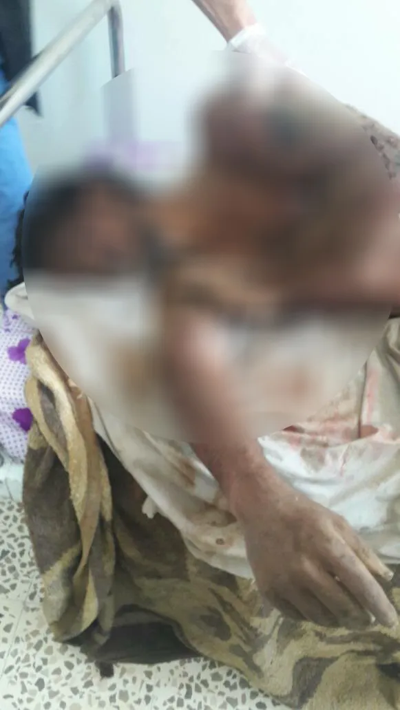 العثور على جثتي المواطنين اللذان اختطفهما جيش الاحتلال التركي يوم أمس