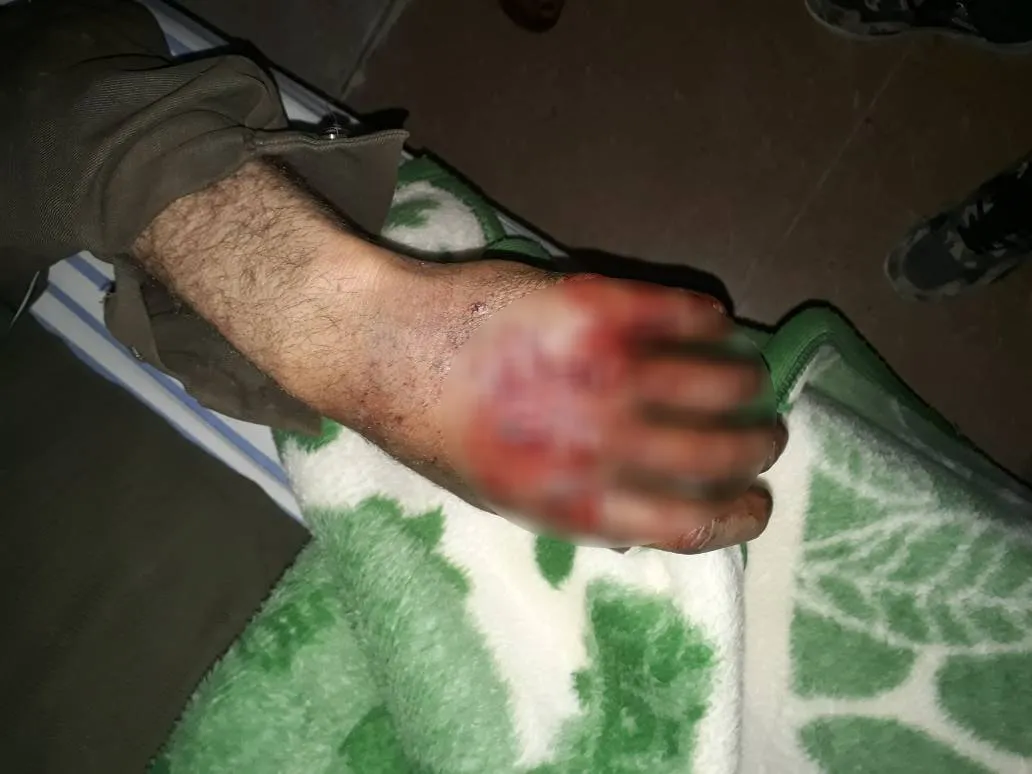 إصابة امرأة مسنة ورجل برصاص جيش الاحتلال التركي في كري سبي