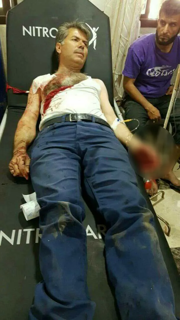 انفجار في مدينة الباب يوقع 9 جرحى