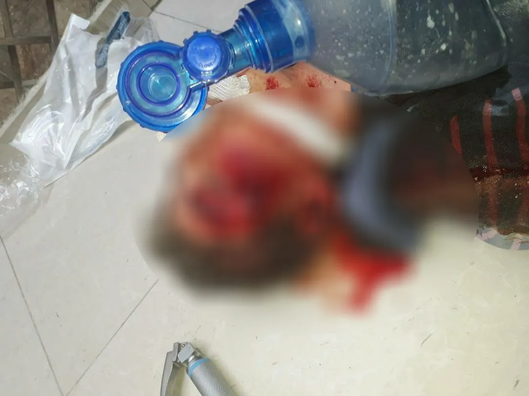 مرتزقة أحرار الشرقية يقصفون أحياء الباب بالأسلحة الثقيلة