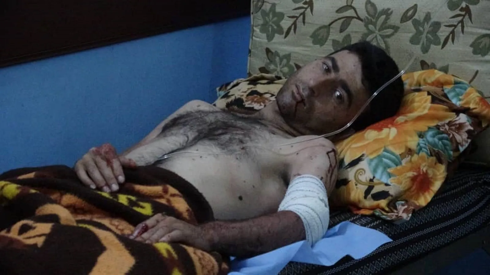 استشهاد وجرح 8 أشخاص من عائلة واحدة بانفجار لغم في تل رفعت