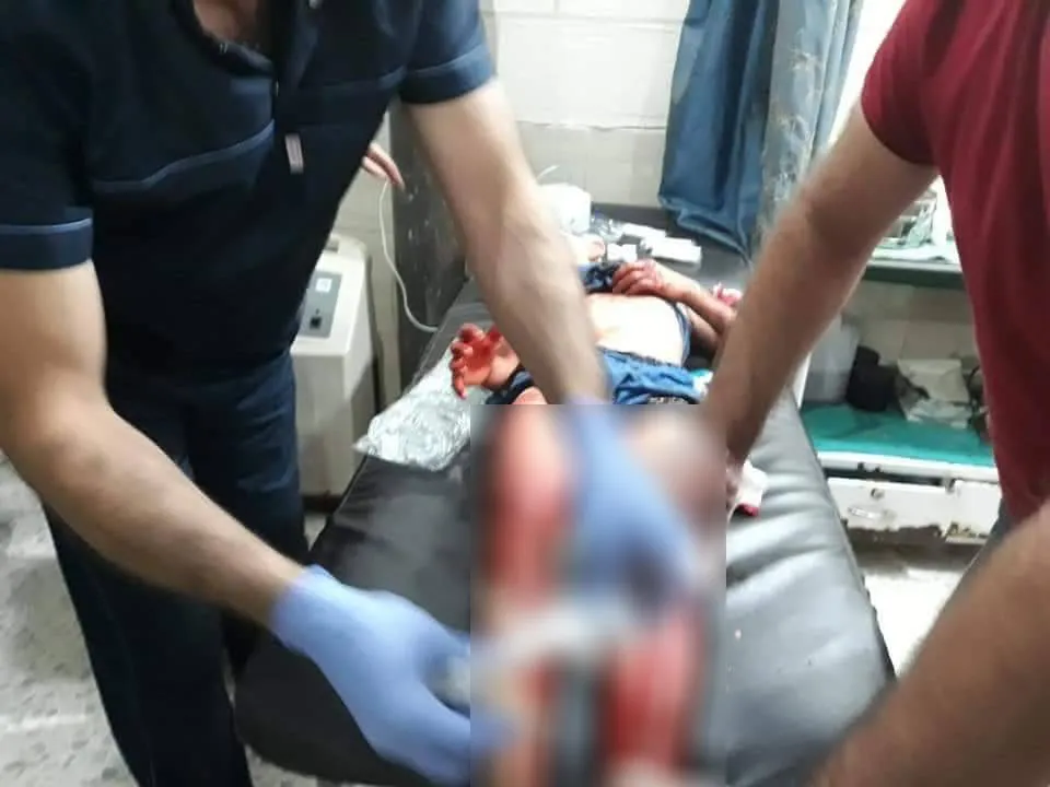 مسنة تفقد حياتها وإصابة 4 من عائلتها في قصف المرتزقة على الزهراء