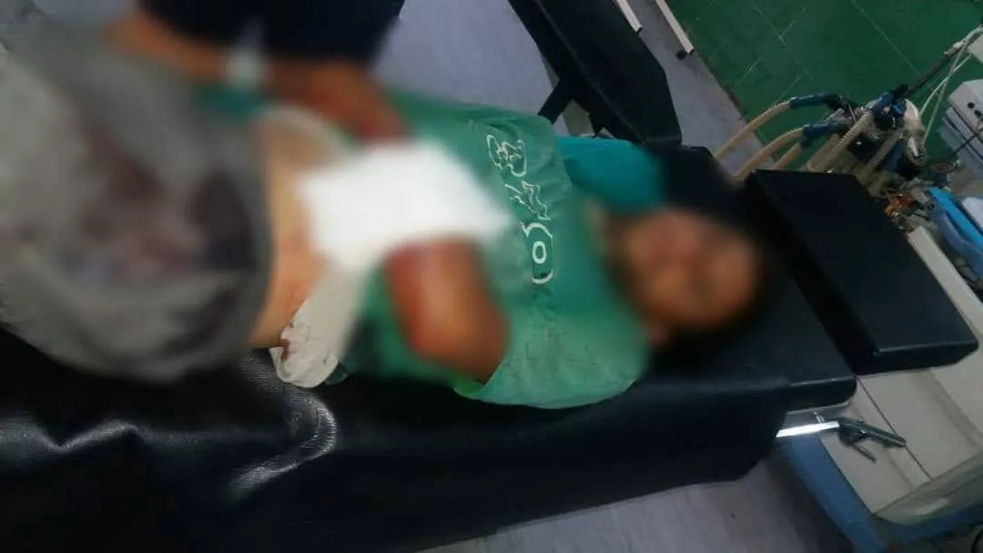 إصابة شاب من سري كانية برصاص جيش الاحتلال التركي
