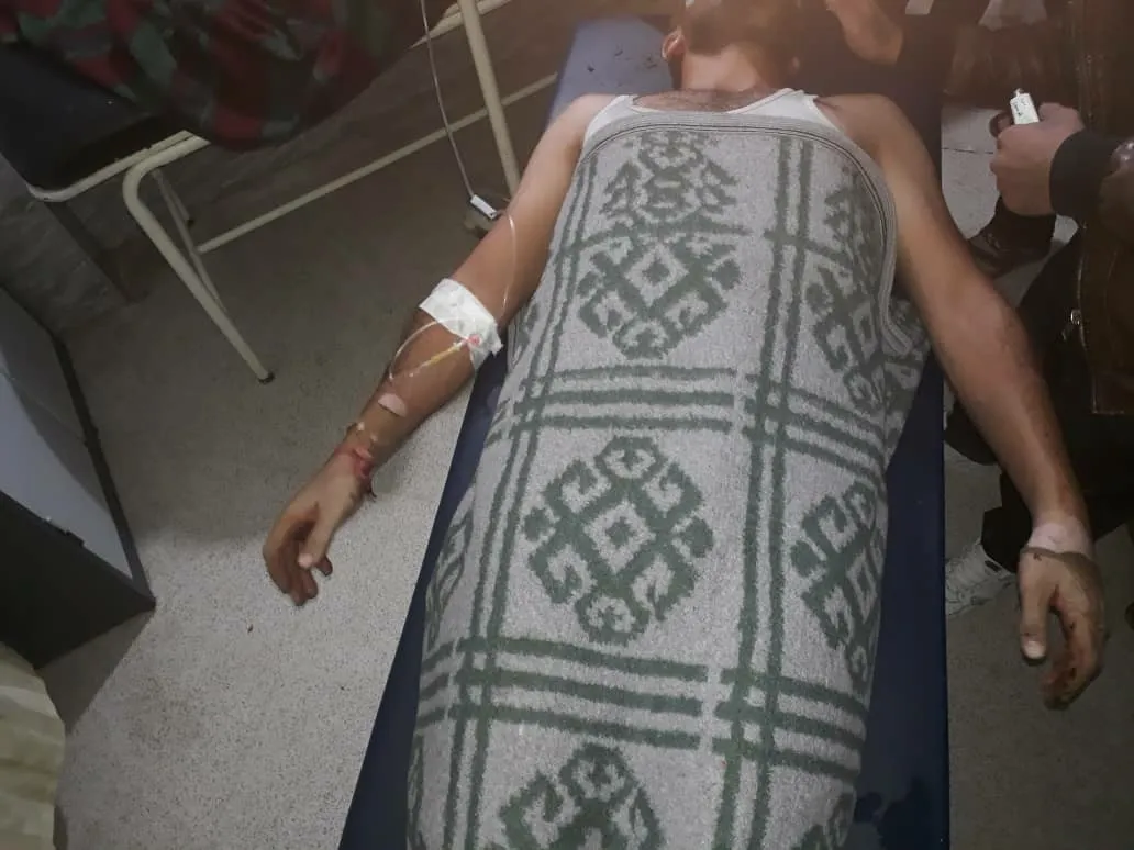 إصابة 4 أشخاص بانفجار أسطوانة غاز في قامشلو