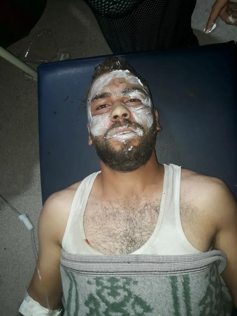 إصابة 4 أشخاص بانفجار أسطوانة غاز في قامشلو