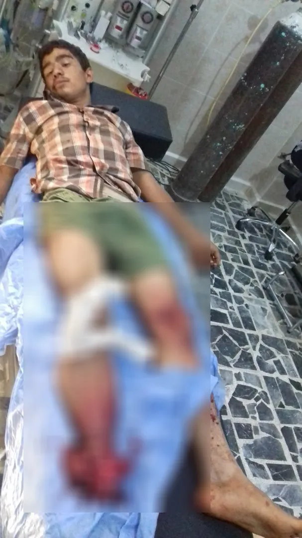 ألغام داعش تهدد حياة أهالي عفرين في الشهباء