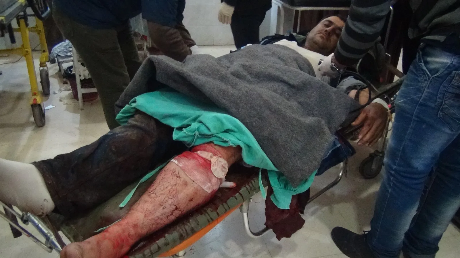 وحشية الاحتلال التركي في عفرين -3
