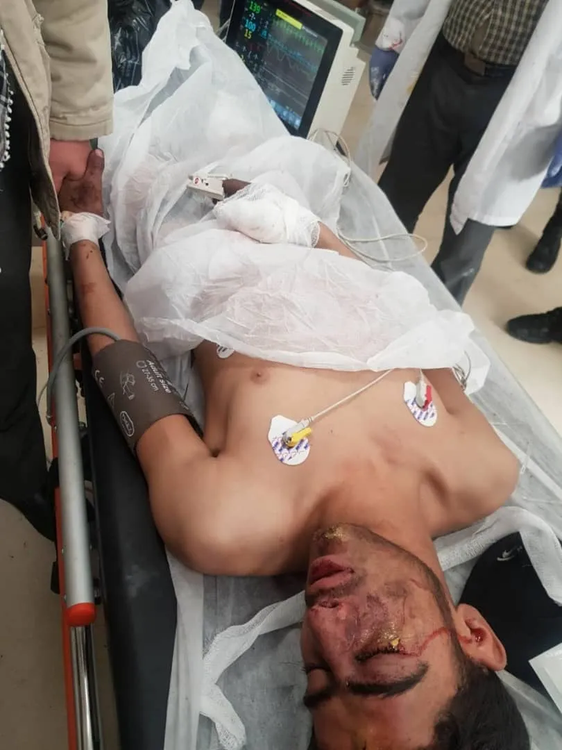 قوات تحرير عفرين تنفذ عملية نوعية في ريف الباب