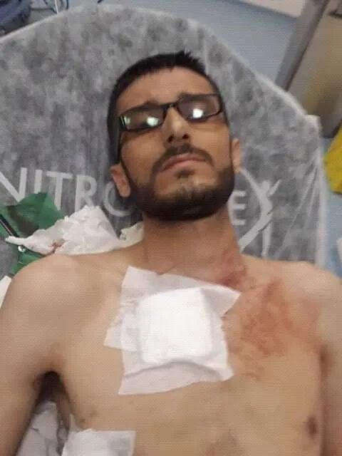يومين متتاليين من الاشتباكات والاضطرابات في مدينة الباب
