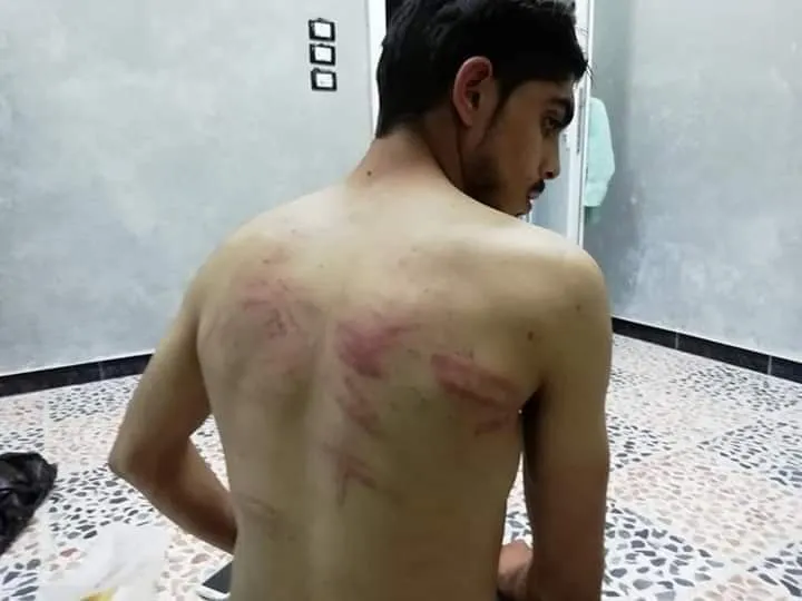 الجندرمة التركية تعذّب ثلاثة أشخاص تابعين لمرتزقة تركيا!