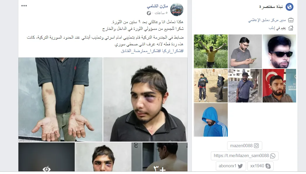 الجندرمة التركية تعذّب ثلاثة أشخاص تابعين لمرتزقة تركيا!