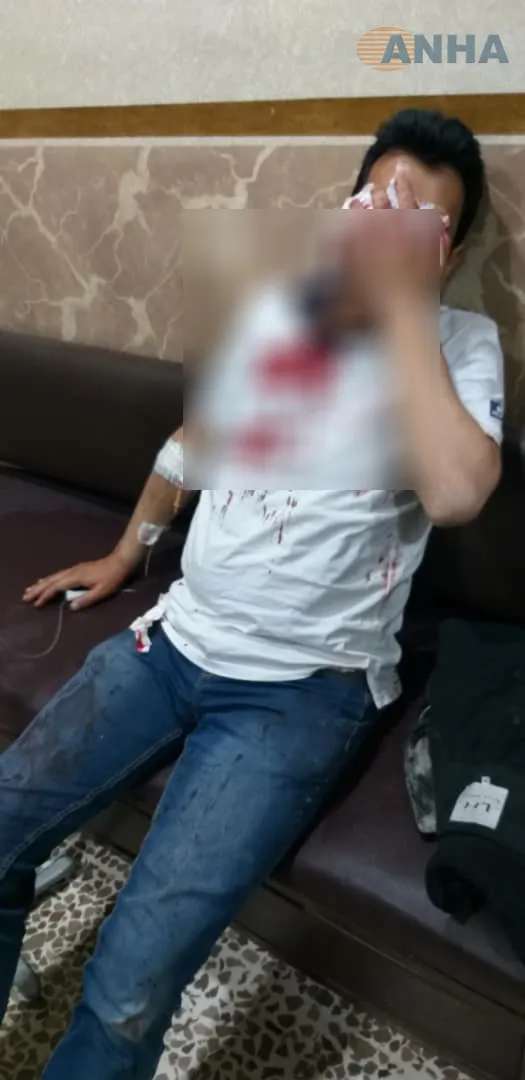 انفجار لغم بسيارة في منبج خلّف 3 إصابات طفيفة – تم التحديث