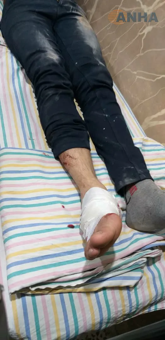 انفجار لغم بسيارة في منبج خلّف 3 إصابات طفيفة – تم التحديث