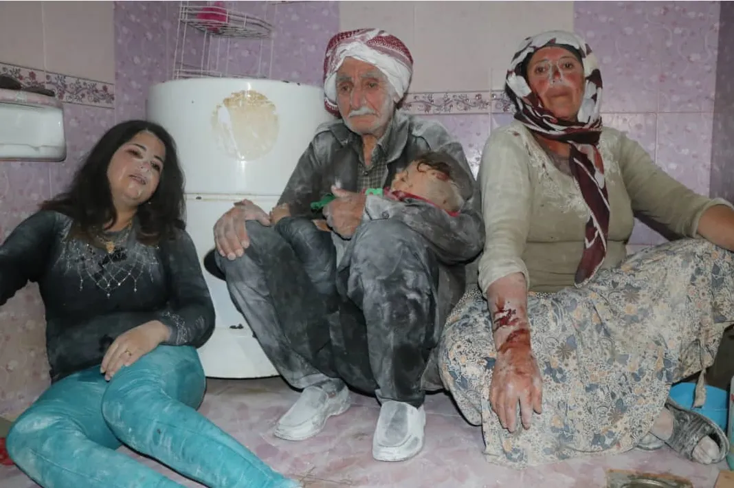 إصابة 5 أشخاص بينهم طفل جراء القصف الوحشي على شيراوا