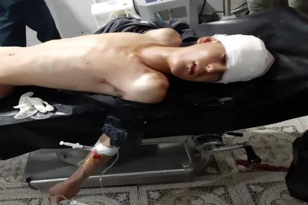 بعد صراعٍ مع الموت.. الطفل ماهر يفقد حياته عقب الاستهداف التركي