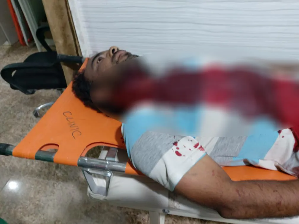 نساء داعش يحاولن نحر عامل دفن الموتى بمخيم الهول