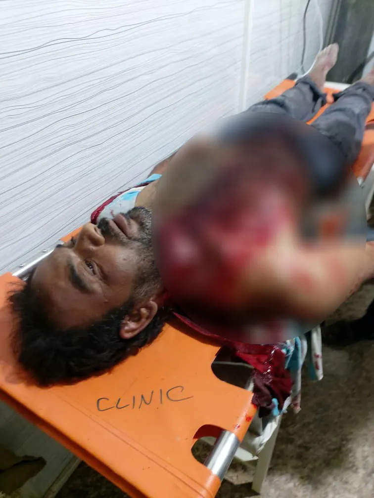 نساء داعش يحاولن نحر عامل دفن الموتى بمخيم الهول