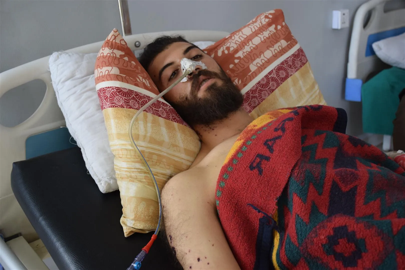 صحفي أصيب في  سريه كانيه: رغم علمهم بأن القافلة مدنية استهدفوها في السوق