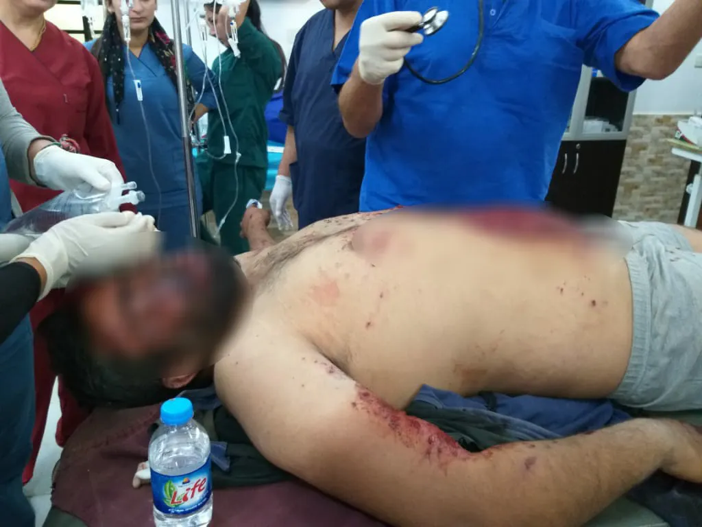 انفجار لغم لجيش الاحتلال التركي بمواطن في سريه كانيه