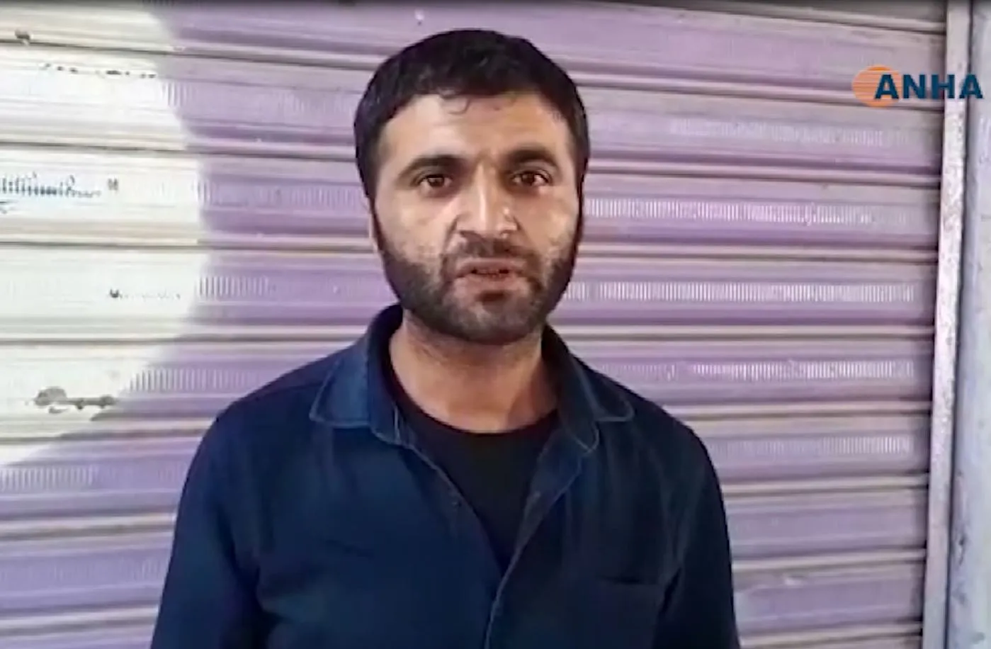 إصابة مراسل وكالتنا محمد أكنجي في سري كانيه- تم التحديث