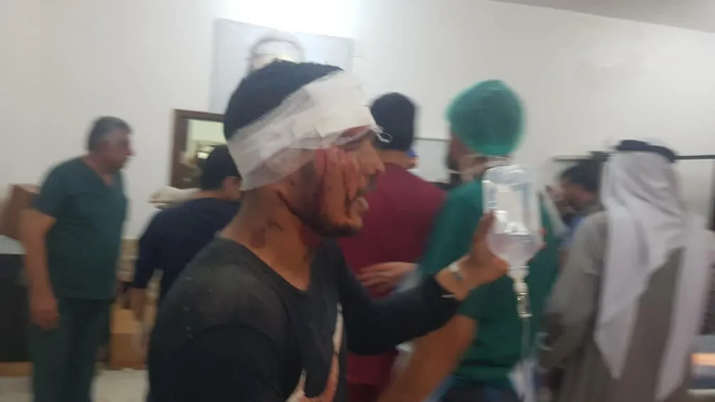 جيش الاحتلال التركي يرتكب مجزرة: 11 شهيد مدني و74 جريح في قصف موكب المدنيين