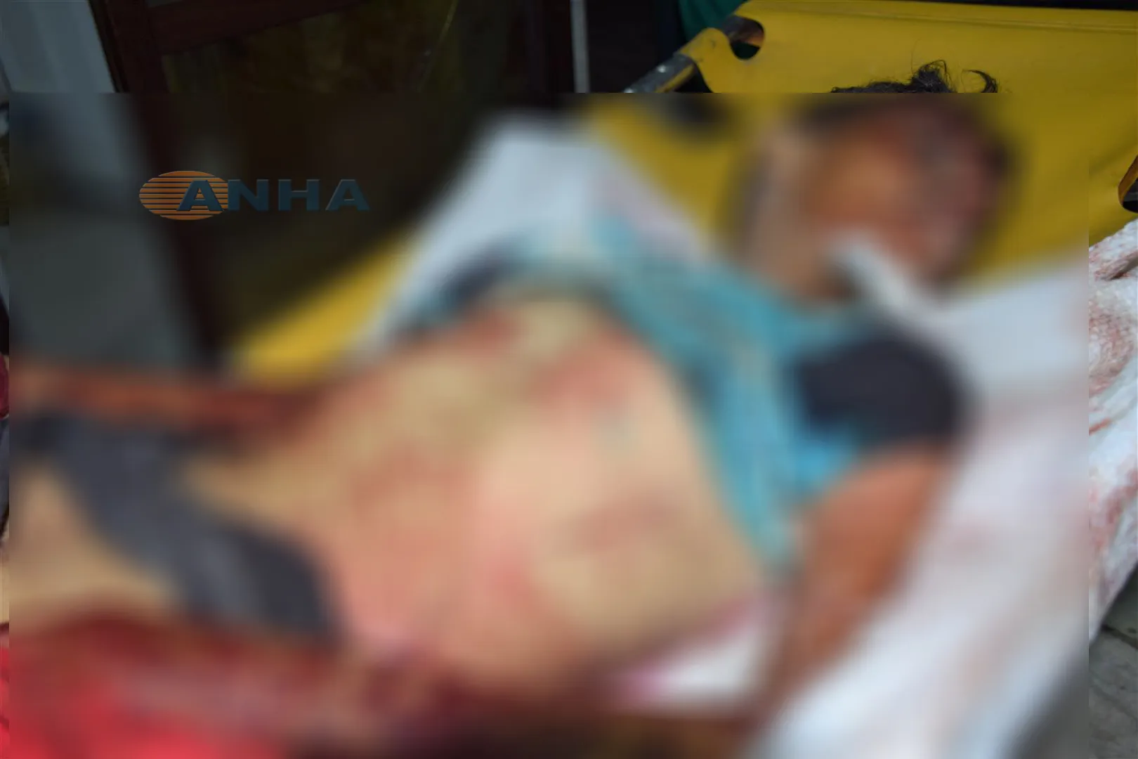 ألغام جيش الاحتلال تقتل طفلاَ وتصيب مسناً بجراح