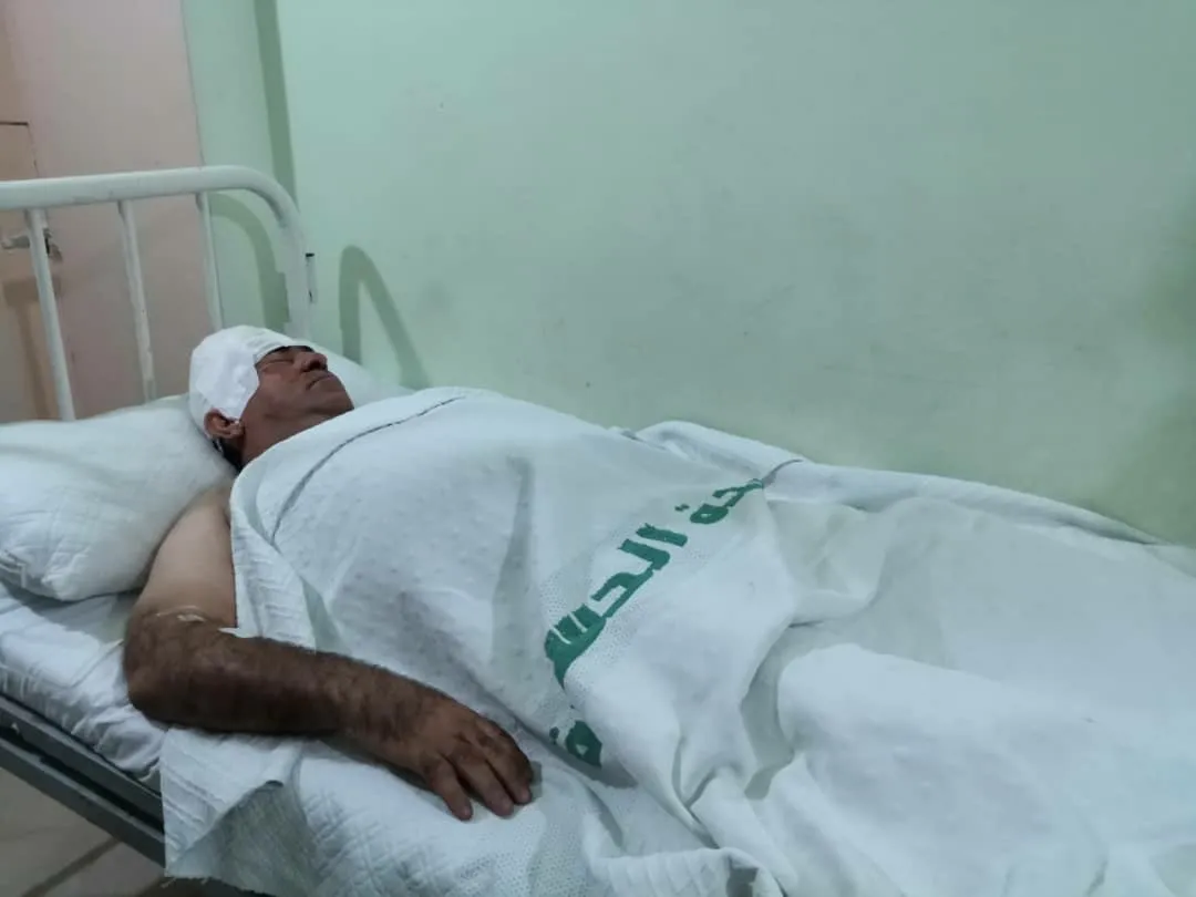 إصابة شقيقين بقصف تركي على ريف قامشلو الشرقي