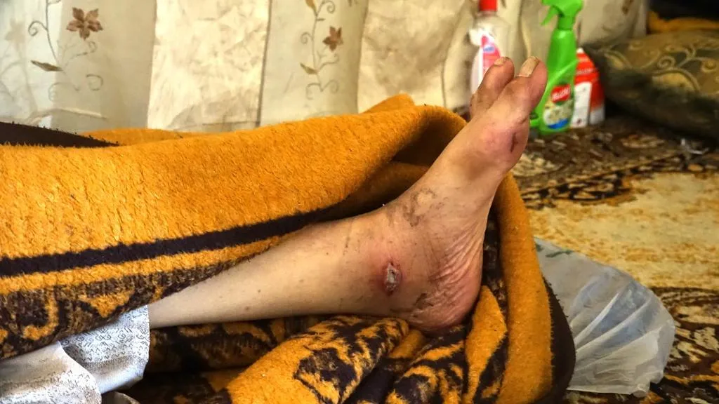مهجرو تل ابيض بين مطرقة القصف وسندان القنص