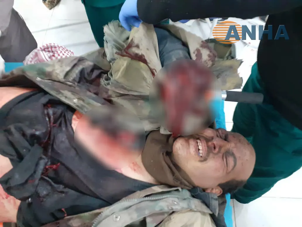 الطيران الحربي التركي يحوم على حدود كوباني والاستطلاع يقصف قوات النظام في تل تمر