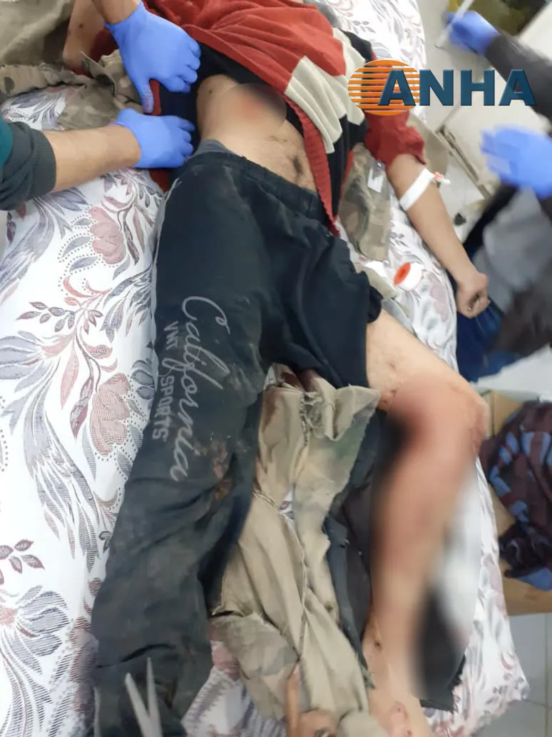 الطيران الحربي التركي يحوم على حدود كوباني والاستطلاع يقصف قوات النظام في تل تمر