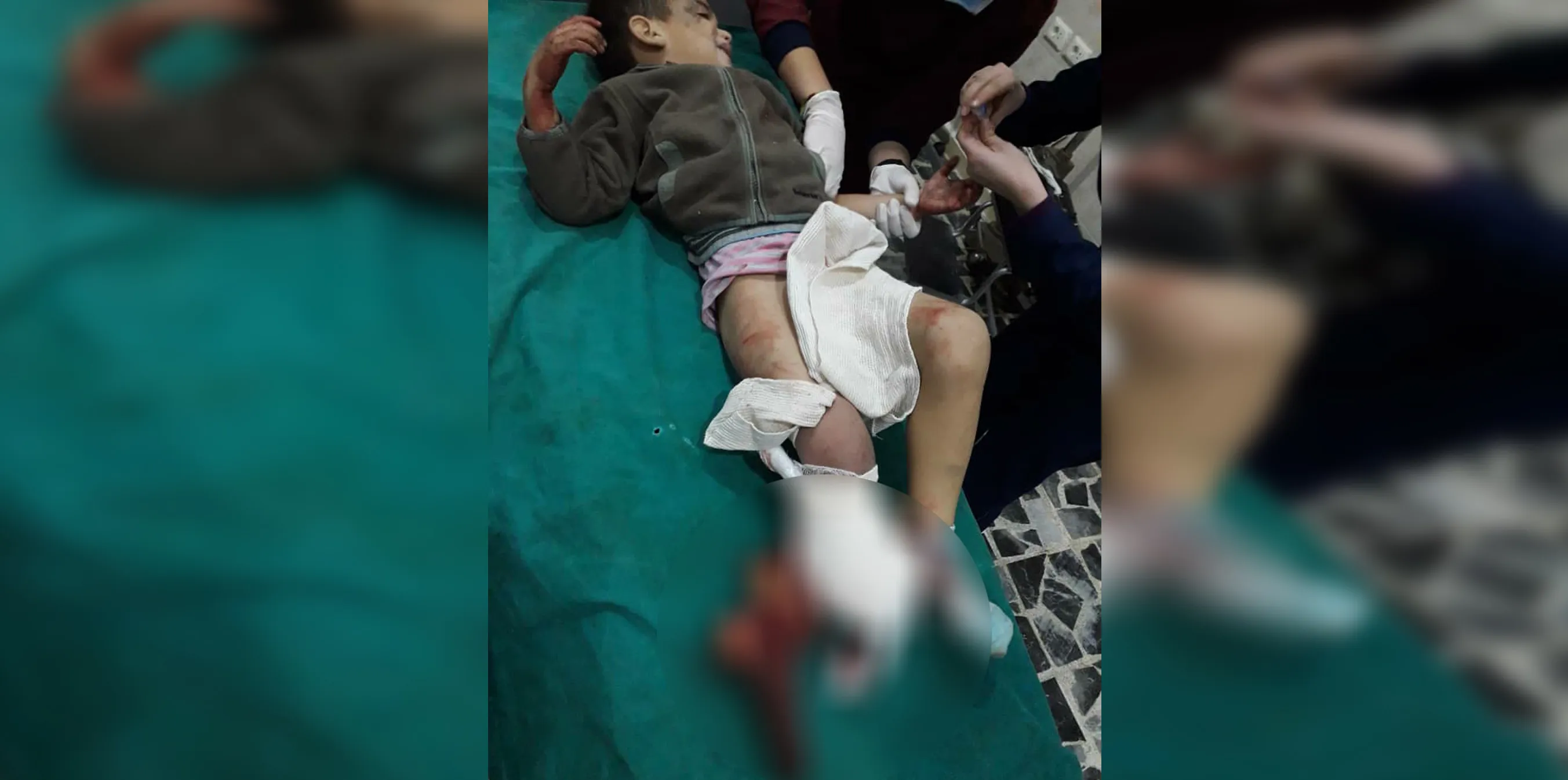 اليونيسف حزين على أطفال تل رفعت ولكنه لا يدين تركيا ومرتزقتها على المجزرة!