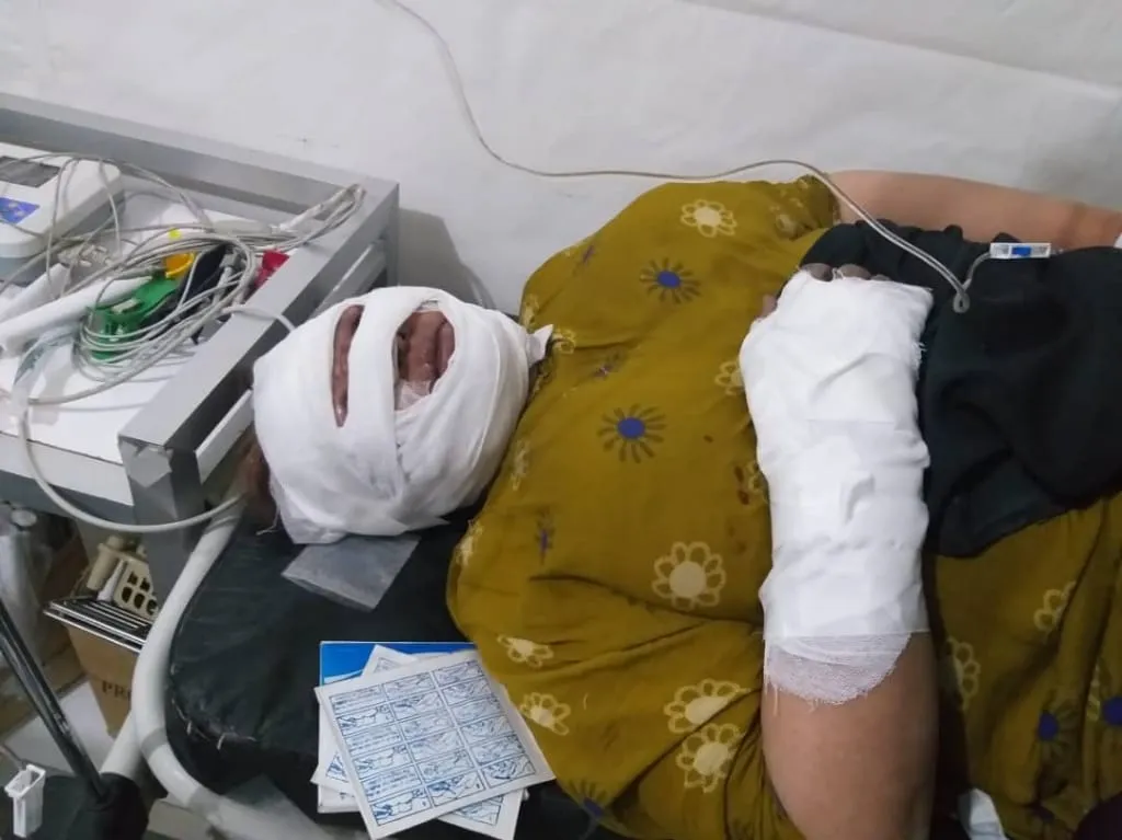 إحراق مجموعة من الخيم في أخطر مخيم في العالم " الهول"