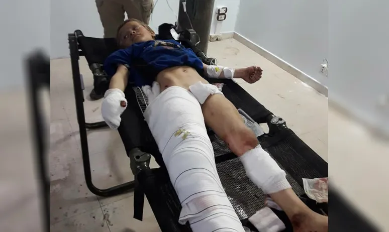 استشهاد طفل وإصابة طفلين بانفجار لغم زرعة المرتزقة بريف كري سبي- تم التحديث