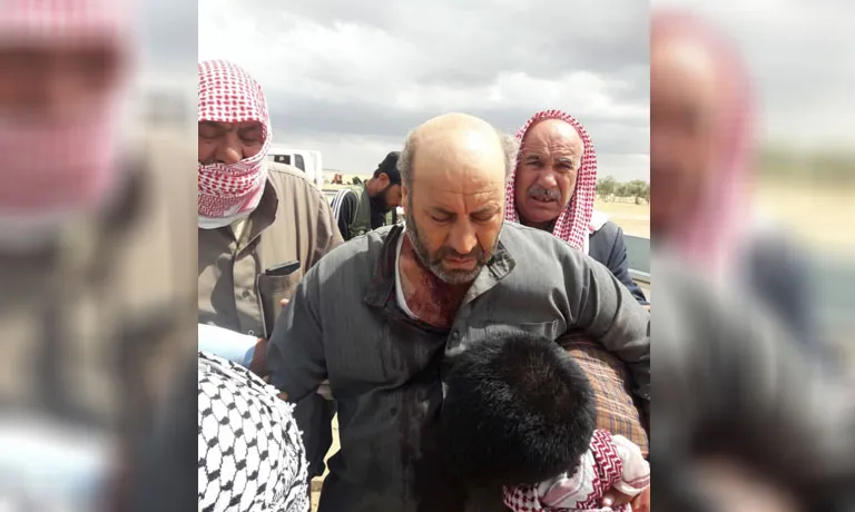 ​​​​​​​إصابة راعي بعد استهدافه من قبل الاحتلال التركي