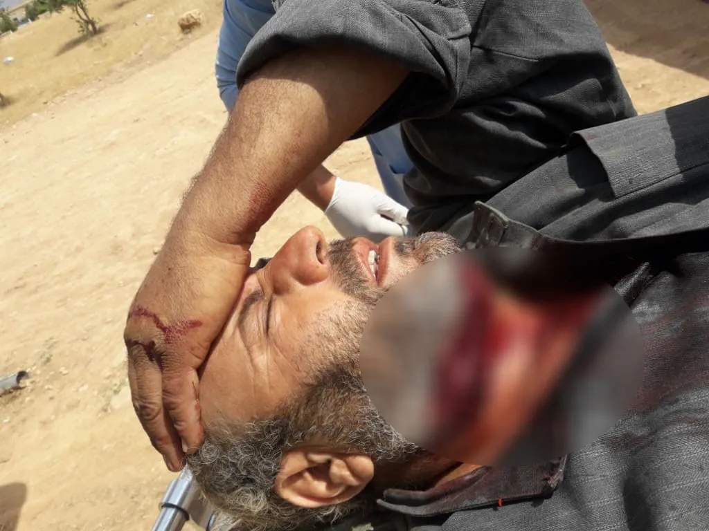 ​​​​​​​إصابة راعي بعد استهدافه من قبل الاحتلال التركي