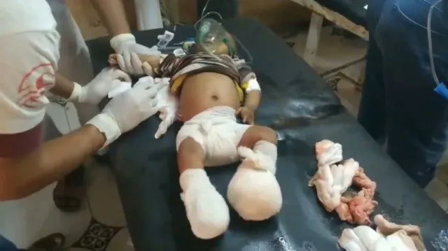 مقتل وجرح 17 شخصًا في مجزرة ارتكبها الحوثيون غرب اليمن