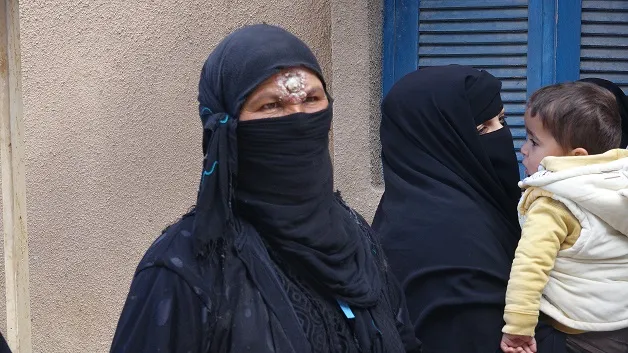 بجهود لجنة الصحة في الطبقة انخفاض حالات الإصابة بالليشمانيا