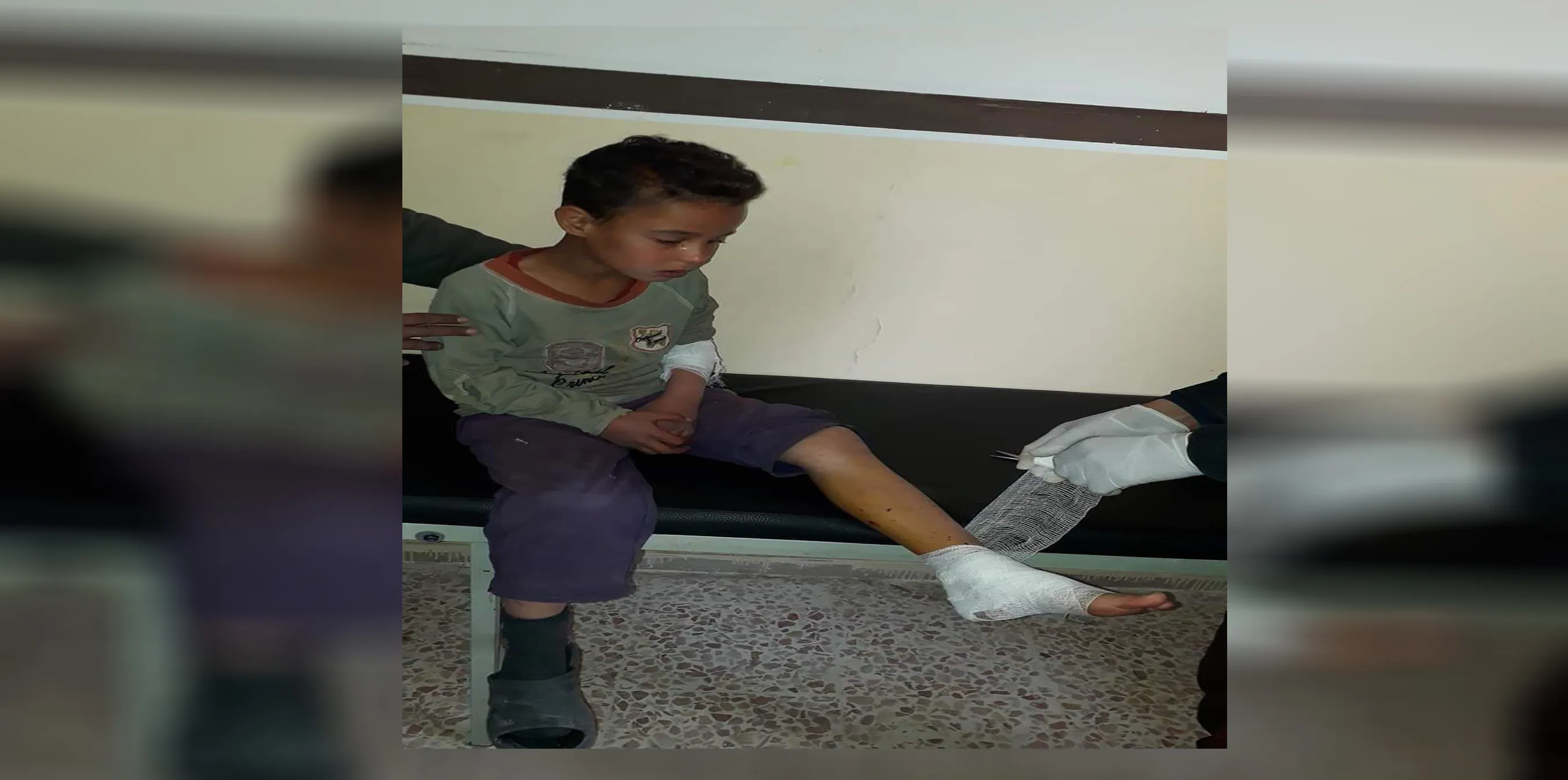 إصابة طفل بانفجار جسم من مخلفات داعش في الباغوز