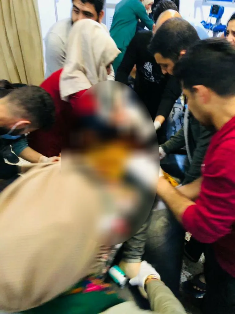 ​​​​​​​استشهاد طفل وإصابة 5 مدنيين بالقصف التركي على ريف عين عيسى- تم التحديث