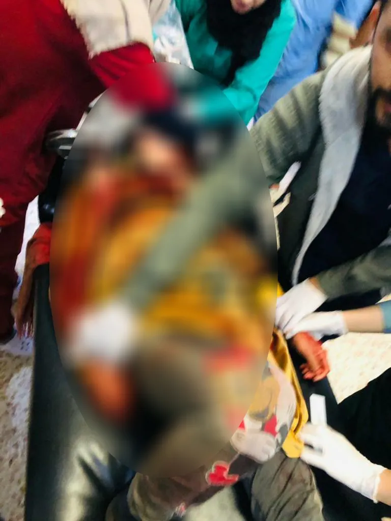 ​​​​​​​استشهاد طفل وإصابة 5 مدنيين بالقصف التركي على ريف عين عيسى- تم التحديث