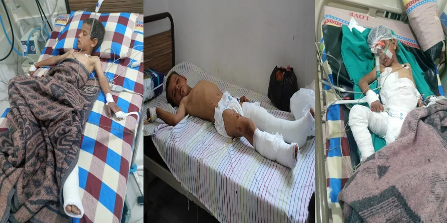 فقدان 3 أطفال لحياتهم وإصابة آخرين نتيجة انفجار قذيفة من مخلفات الحرب