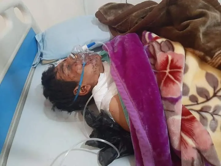 إصابة طفل في ريف دير الزور الشرقي في انفجار لغم من مخلفات داعش