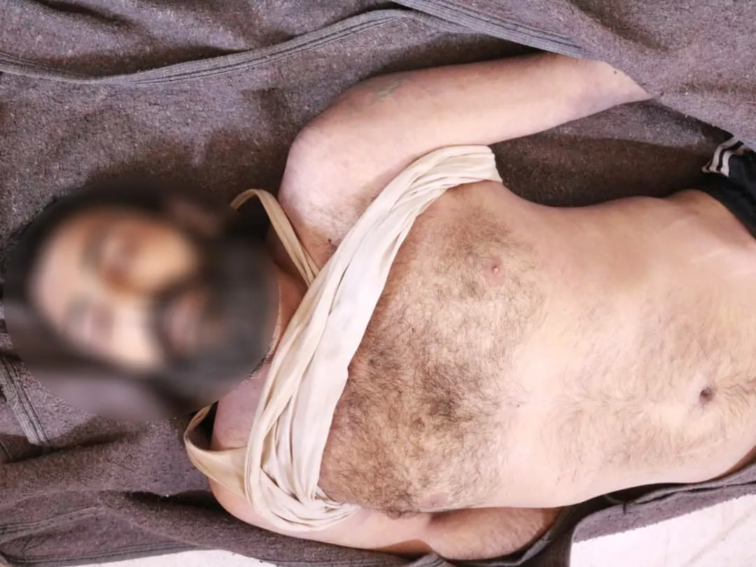 الشاب أمين عيسى توفي إثر جلطة دماغية ولا توجد آثار تعذيب على جسده
