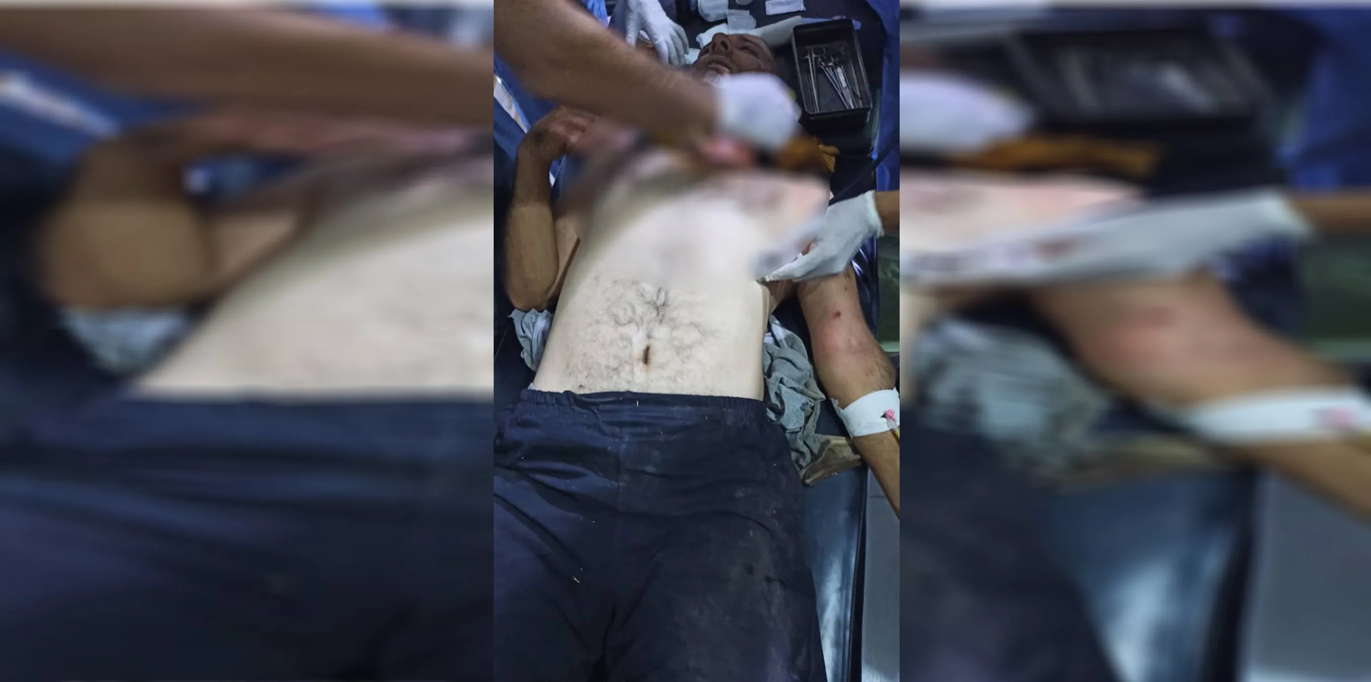 إصابة عنصر من قوات حكومة دمشق بقصف الاحتلال التركي لقرية تل جمعة الاشورية
