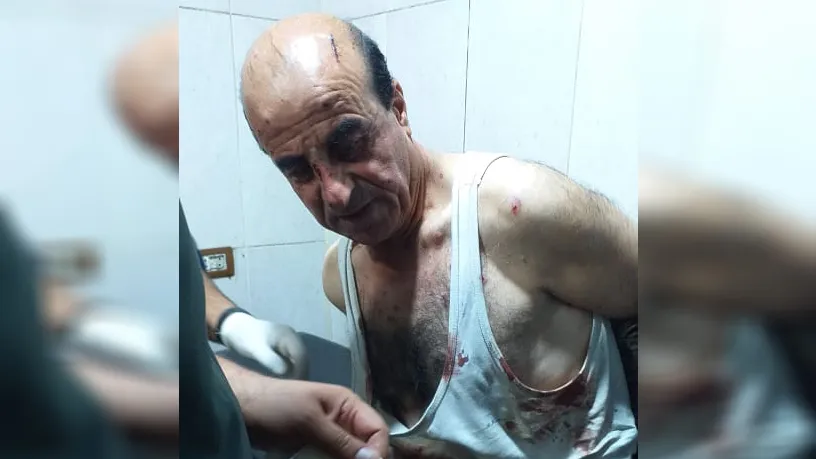 وصول عدد من جرحى زركان إلى مشافي الحسكة
