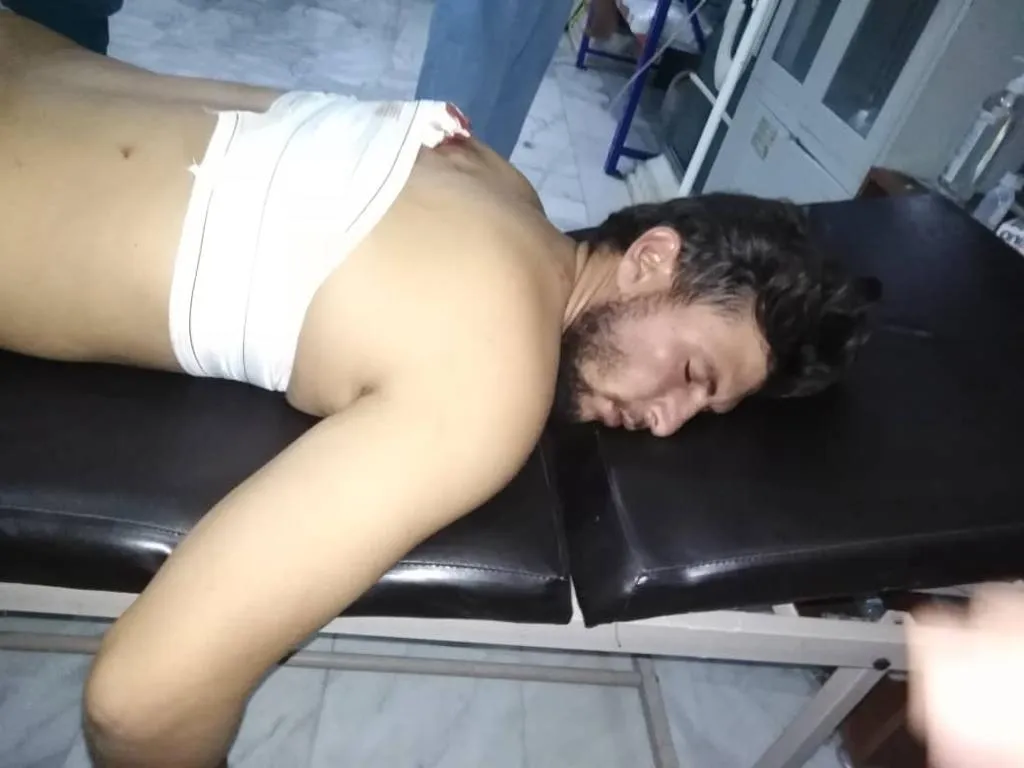 إصابة مدني في قصف الاحتلال التركي ومرتزقته لقرية مشيرفة وطريق M4